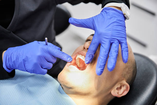 Best Knocked-Out Tooth (Avulsed Tooth) Treatment in Round Lake Park, IL